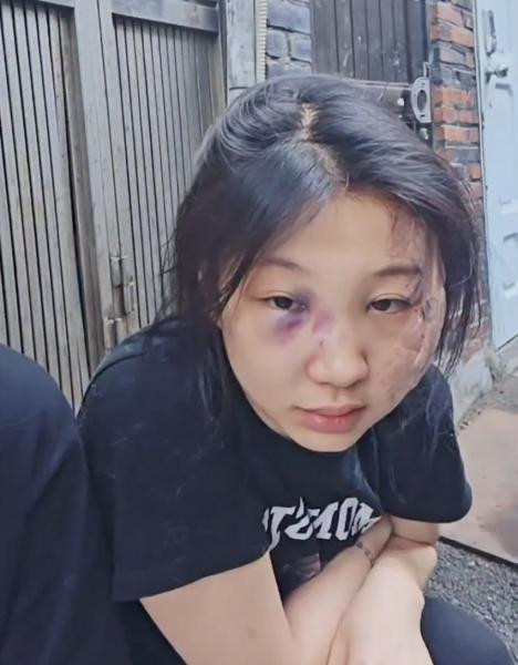 합방하다 처맞은 여자BJ.jpg